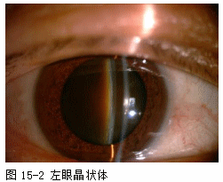 ZY016_74_3.gif